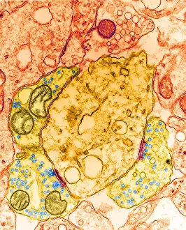 Transmission Electron Microscopy (TEM) Stampe: Synapse, TEM